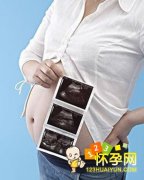 五种检查可预测胎儿